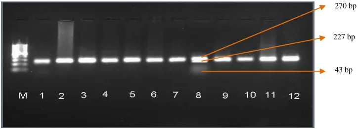 Gambar 2. Hasil Visualisasi Produk PCR Gen PPAR-γ2; Marker DNA Ladder 100 bp (M), Fragmen DNA berukuran 270 bp (1-10)  