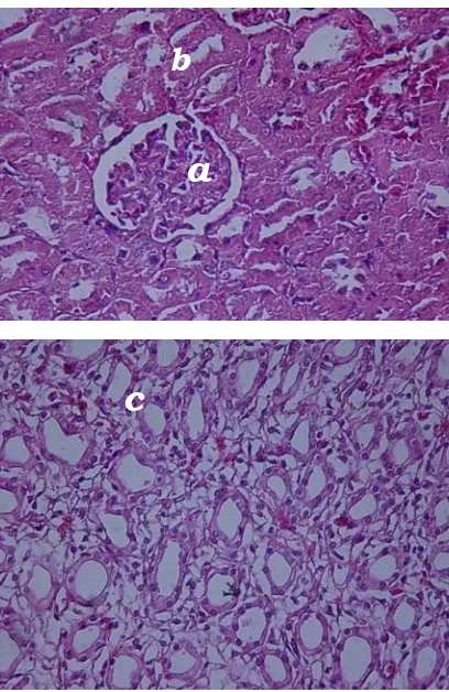 Gambar 2. Gambaran histopatologik ginjal kelompok tikus ovariohisterektomi dengan pakan standart dan suplementasi kalsium 75 mg/ekor/hari (P1), terlihat bahwa sel-sel epitel tubulus kontortus distalis berbentuk kuboid dan relatif normal (c) (Pewarnaan H.E., 400X) 