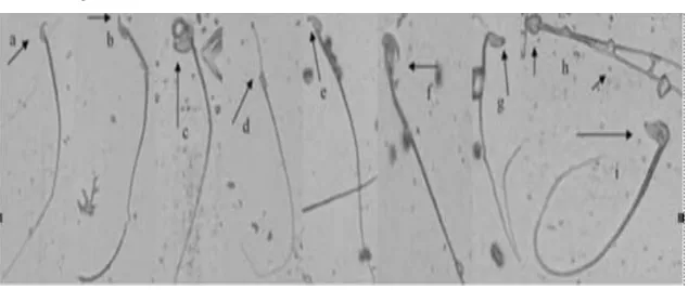 Gambar 3. Morfologi spermatozoa mencit. (a) spermatozoa normal, (b) pengait salah membengkok, (c) sperma melipat, (d) kepala terjepit, (e) pengait pendek, (f) kesalahan ekor sebagai alat tambahan, (g) tidak ada pengait, (h) sperma berekor ganda, (i) kepala