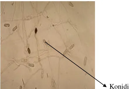 Gambar 1. Jamur C. gloeoporoides secara mikroskopis        