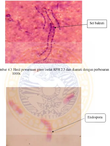 Gambar 4.3 Hasil pewarnaan gram isolat RPH 2.3 dan diamati dengan perbesaran 