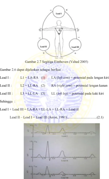 Gambar 2.7 Segitiga Einthoven (Vahed 2005) 