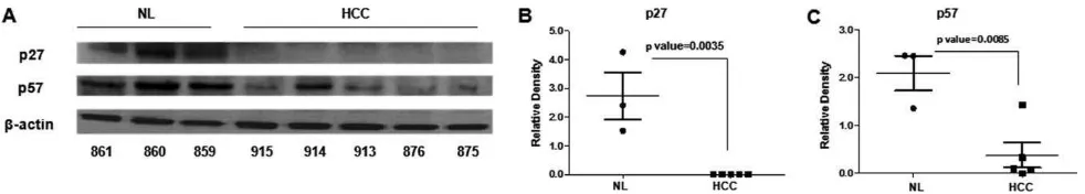 Fig. 4. miRNA expression in liver nodules versus healthy liver of TG mice. (A-D) MicroRNA expression analysis in liver cancer versus healthy livers