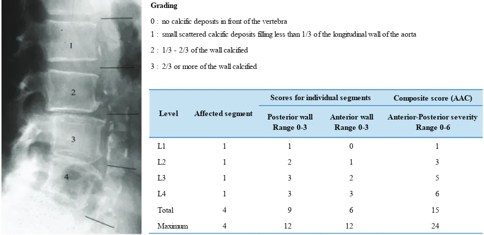Figure 1. Abdominal aorta calcification (AAC) scoring.(10) (Adapted with permission from Nature Publishing Group).
