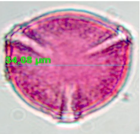 Gambar 8. Polaritas dan simetri serbuk sari pada C. papaya         simetri radial (tampak polar) 