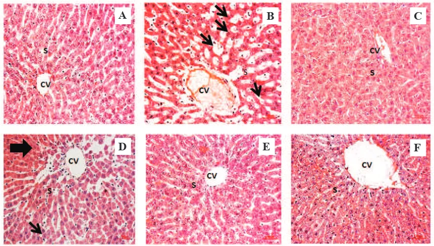 Figure 1. Influence of A. flava stem extract on SGOT, SGPT and GGT of acetaminophen-induced rats