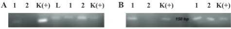 Figure 1. MSP result for RASSF1A (A) and CDKN2A (B) methylation detection. (A) Sample 1 is a methylation sample and sample 2 is an unmethylation sample