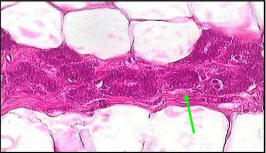 Gambar 4.4. Pengamatan mikroskopis kelenjar mammae pada perlakuan IV (HE, 40x10). Tanda panah menunjukkan hiperplasi pada sel epitel kelenjar mammae