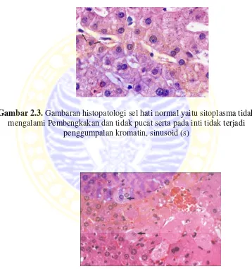 Gambar 2.3. Gambaran histopatologi sel hati normal yaitu sitoplasma tidak 