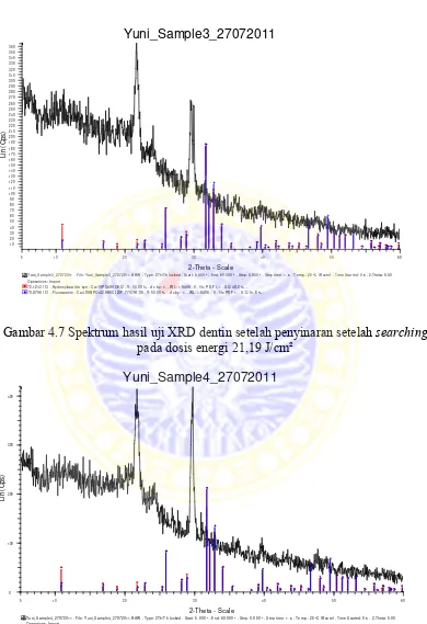 Gambar 4.7 Spektrum hasil uji XRD dentin setelah penyinaran setelah searching 