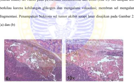 Gambar 2.5 Gambaran nekrosis sel pada jaringan kulit mencit dengan perbesaran 4X dan 10X melalui pengamatan mikroskop (Chen et al., 2012) 