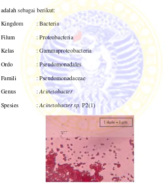 Gambar 2.  Morfologi sel  Acinetobacter sp. P2(1) perbesaran 1000x 
