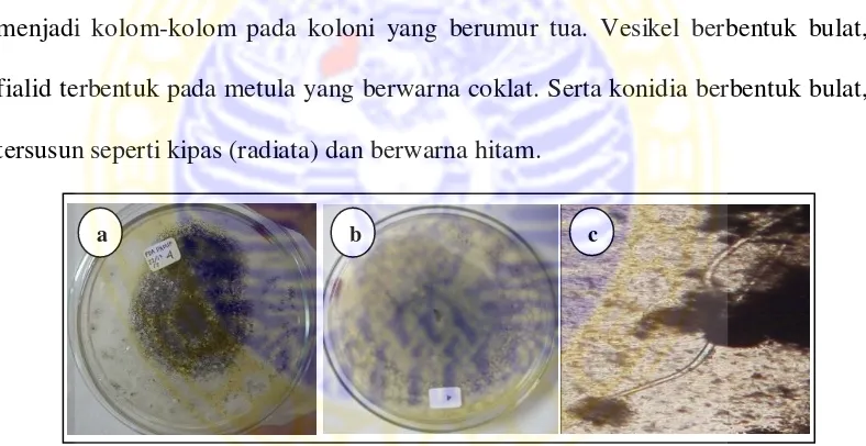 Gambar 4.1. Isolat kapang Aspergillus niger, top versea. karakter makroskopis , b. karakter makroskopis reverse, c