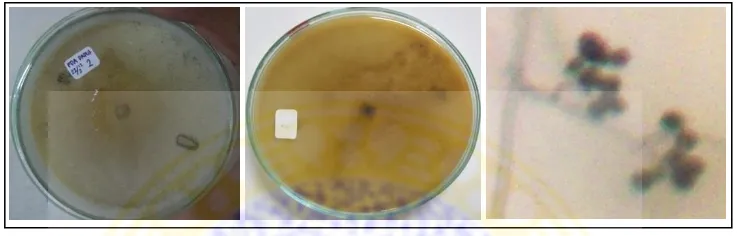 Gambar 4.7. Isolat kapang Trichoderma sp.2. a. karakter makroskopis top 