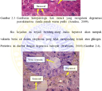 Gambar 2.4 Gambaran histopatologis hati mencit yang mengalami degenerasi  hidropik (tanda panah warna putih) (Amalina, 2009)