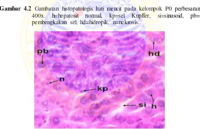 Gambar 4.2 Gambaran histopatologis hati mencit pada kelompok P0 perbesaran 