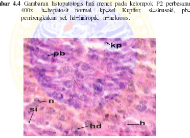 Gambar 4.4 Gambaran histopatologis hati mencit pada kelompok P2 perbesaran 