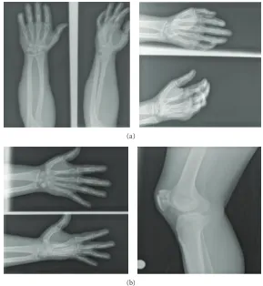 Figure 3: (a) Training Set. (b) Testing Set.