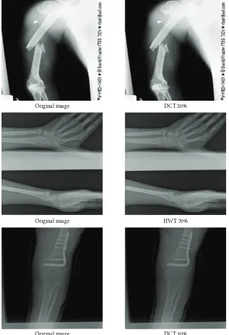 Figure 6: Examples of testing set image compression using the developed system.