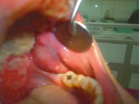 figure 1. First visit: Extra oral view.