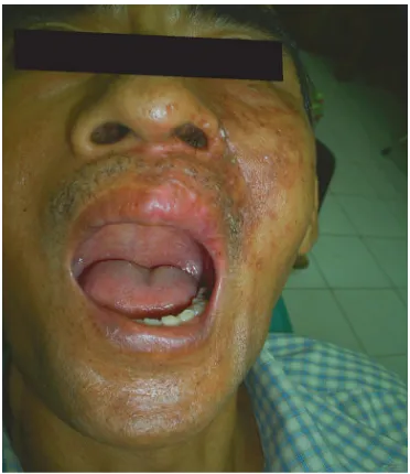 figure 5.  Post treatment: extra oral view. 