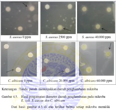 Gambar 4.5.Hasil pengamatan diameter daerah penghambatan pada mikroba 