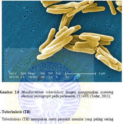 Gambar 2.6 Mycobacterium tuberculosis dengan menggunakan scanning 