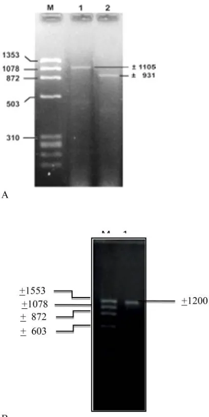 Figure 1. The agarose gel electroforosis ofthe PCR product. A. The PCR product of thecoding sequences of Mage-1 gene fromFNAB of hepatic tissue of the carcinomahepatocelluler patients (Mastutik et al 2008,2010) 1= the first round of the PCR product(+ 1105 