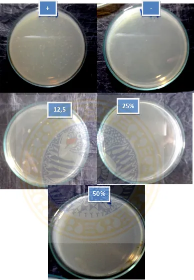 Gambar 5.2 Pertumbuhan bakteri plak supragingiva pada konsentrasi ekstrak 