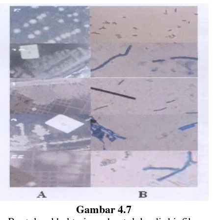Gambar  4.8 Bentuk bakteri limbah cair (Murachman, 2005)  