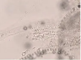 Gambar 5.  Sampel bulu kelinci dari luka infeksi ditulari T. mentagrophytes.      Tampak sel-sel                      spora bulat membentuk rantai di pinggir luar bulu