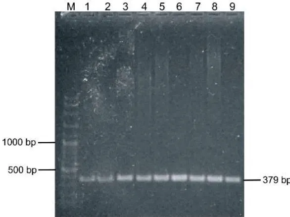 Figure 2. Kappa-casein (KCN) gene found in all buffalo samples at 379 bp 