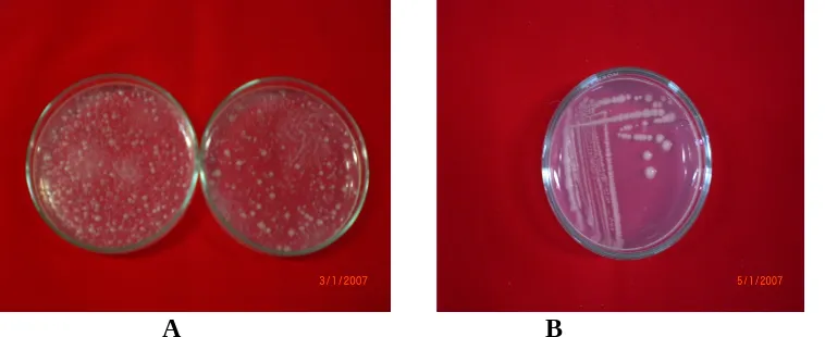 Gambar 1: Sebaran dan bentuk koloni bakteri endofit pada medium NA dari sampelperakaran  tanaman  bawang  Alahan  Panjang  (A)