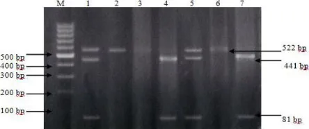 Gambar 3. Contoh hasil PCR-PFLP pada gen leptin (Lep/BsaI) di bagian ekson 3 pada sapi Bali 