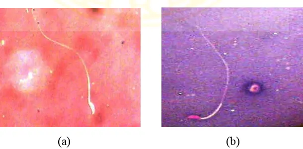Gambar 4.6 Viabilitas spermatozoa, spermatozoa yang masih hidup (a), spermatozoa yang telah mati (b), perbesaran 400x 
