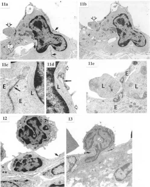 FIG. 12. by spherical mononuclear PI. Frc. TEM of mononuclear cell almost completely surroundedEC at point removed from the tight EC junction (anow)