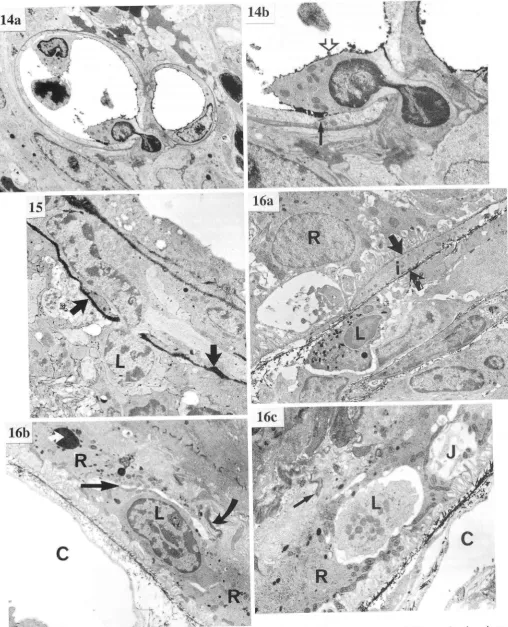 FIG. ^S".1i; ;;;;;.ilMigtating iii .o"t"a -igt"ti"c *itft process ra 14. TEM of lymphocyte in the of extravasation' dayPrI ", ilit*gt, two retinal microvessels showing adherentcells