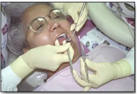 Gambar 5. Penggunssn Non-Locking Tissue Forceps(4)