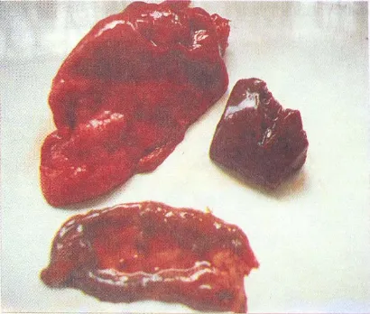 Gambar 1.    Perubahan pada organ paru-paru, hati dan usus sapi pada penyakit radang paha bentuk visceral 