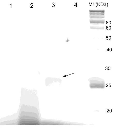 Gambar 2. Profil protein pada SDS- PAGE protein dengan berbagai tahapan pemurnian streptavidin