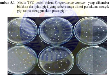 Gambar 5.1  Media TYC berisi koloni Streptococcus mutans  yang dikembang 