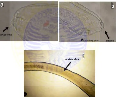 Gambar 2.5. Lava stadium tiga Anisakis simplexKeterangan :  a. bagian anterior  (Mahmoud and Mahmoud, 2005) A