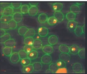 Gambar . Pewarnaan Acridine Orange (AO) P. falciparum, inti 