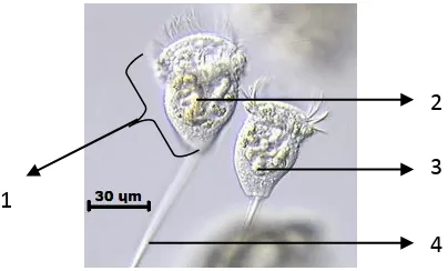 Gambar 2.5. Vorticella sp. (Sunet al.,2006) 