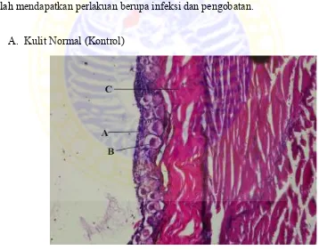 Gambar 9. Gambaran histopatologi kulit benih ikan lele kontrol,pewarnaan HE, perbesaran 200x.Keterangan: (a) sel mukus; (b) kelenjar mukus; (c) epidermis