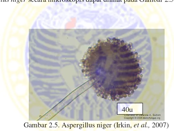 Gambar 2.5. Aspergillus niger (Irkin,  et al., 2007) 