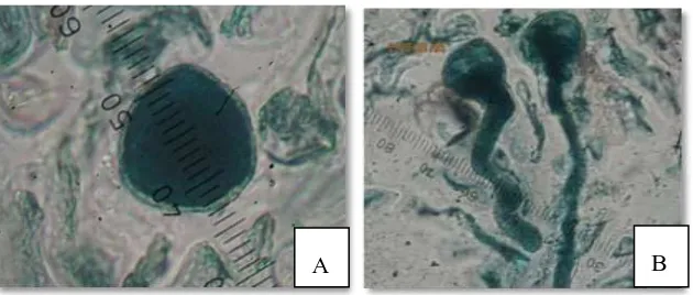 Gambar 3. Foto serbuk sari bunga teratai Sudamala (Nymphoides  indica (L.) Kuntze) hasil uji in - vitro Keterangan: a.Serbuk sari tidak membentuk buluh (nonviabel); b