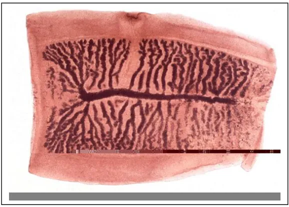 Gambar 3. Skoleks cacing T. solium 