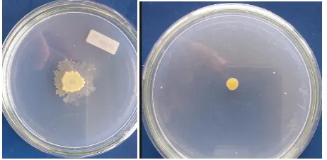 Gambar 5. Isolat Bakteri Pendegradasi Inulin putih (kiri), coklat (kanan)  