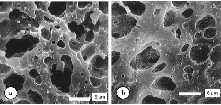Gambar 2. Hasil pemindaian mikroskop elektron pada keju; a) keju lemak penuh, b) keju lemak rendah(Mistry 2001).